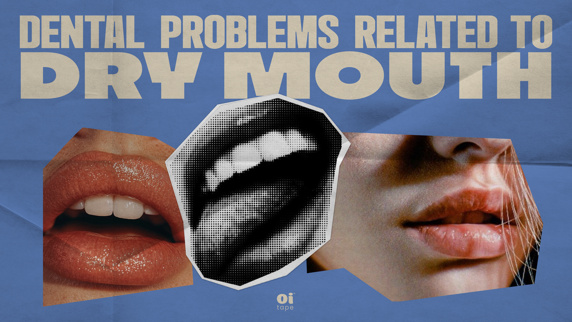Dental Problems Related to Dry Mouth & How Mouth Taping Can Help