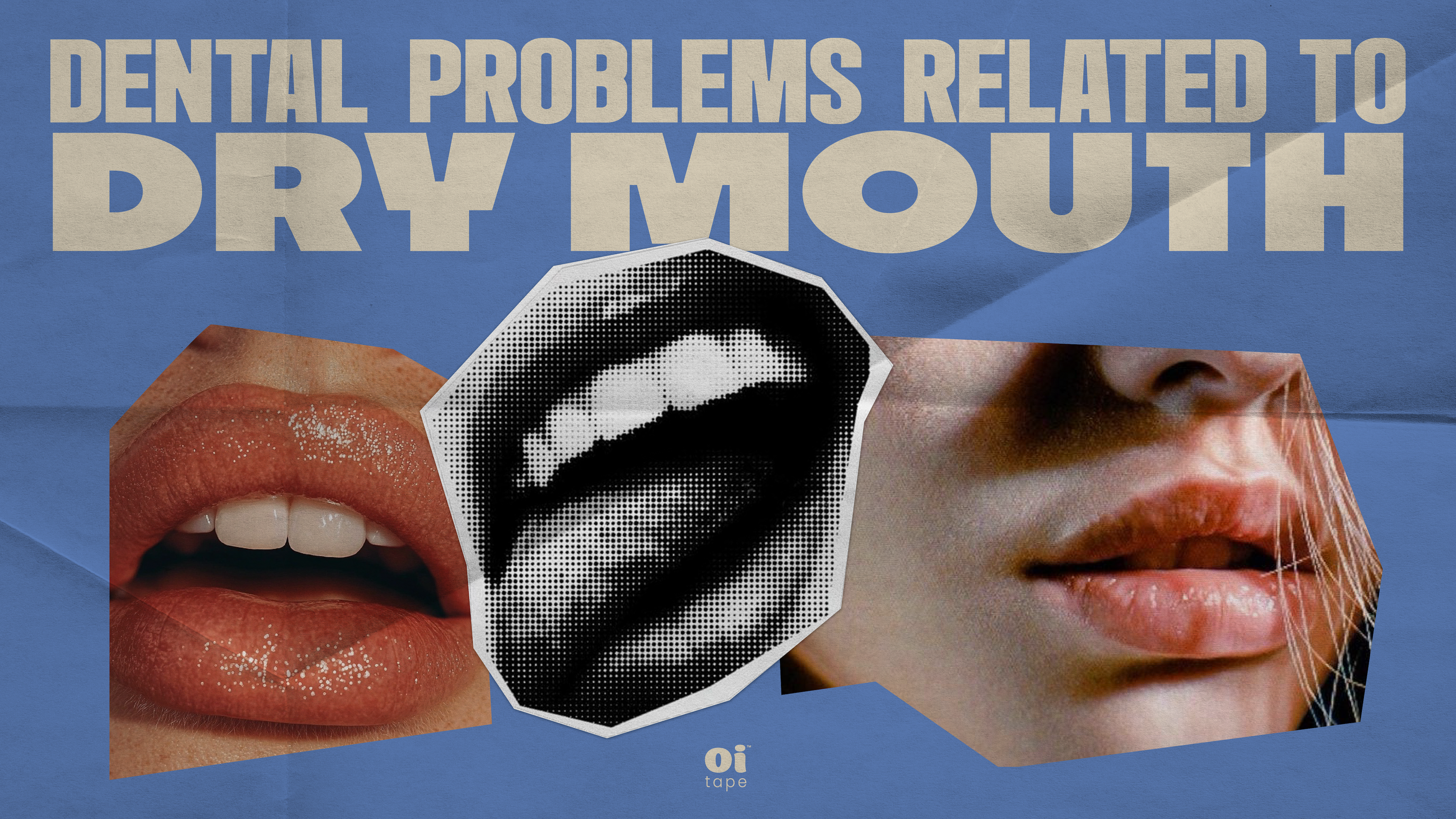 Dental Problems Related to Dry Mouth & How Mouth Taping Can Help